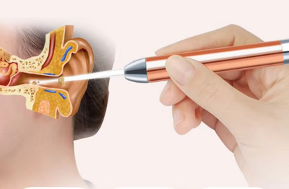 LIMPIADOR OIDOS CON LUZ LED ENDOSCOPIO